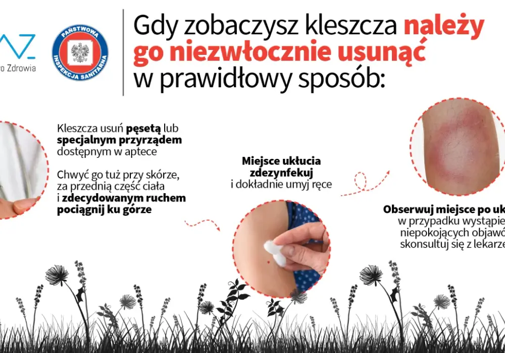 Jak zapobiec boreliozie: skuteczne metody ochrony przed kleszczami