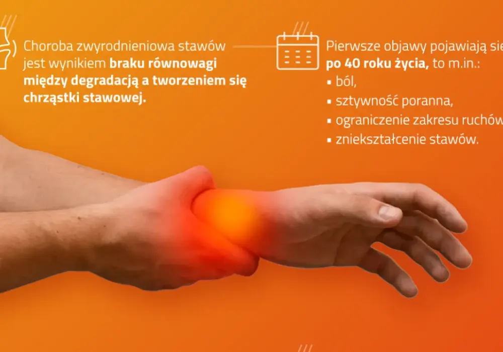 Zwyrodnienie stawów rąk do jakiego lekarza? Kluczowe informacje dla Ciebie