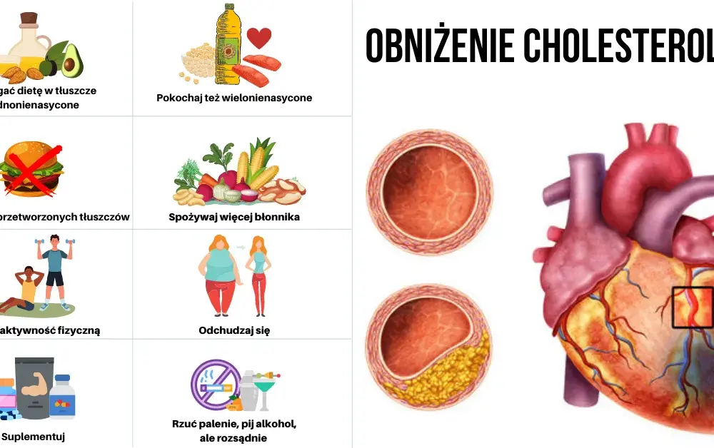 Jak szybko obniżyć cholesterol przed badaniem krwi – skuteczne metody w krótkim czasie