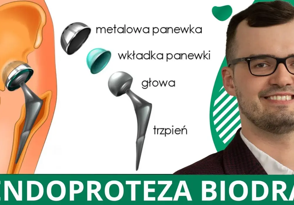 Jakie badania przed operacją endoprotezy są konieczne, by uniknąć powikłań?