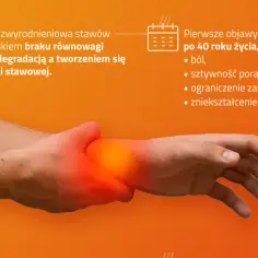 Zwyrodnienie stawów rąk do jakiego lekarza? Kluczowe informacje dla Ciebie
