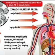 Gorączka krwotoczna objawy: Jak rozpoznać groźne symptomy?