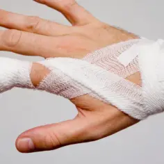 Wybity palec do jakiego lekarza? Sprawdź, jak uniknąć bólu i problemów