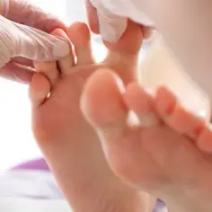 Jak się nazywa lekarz od paznokci i co może dla Ciebie zrobić