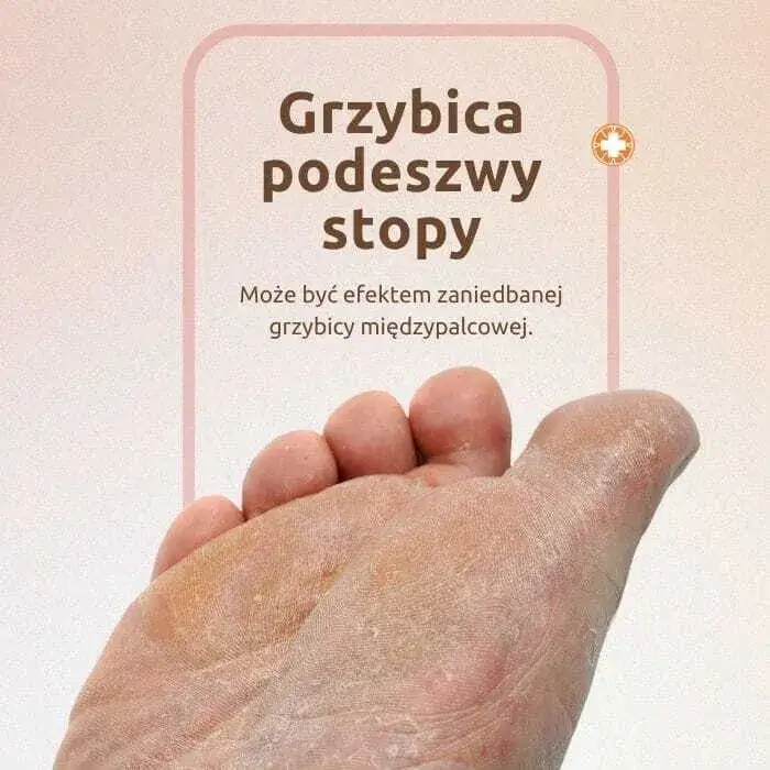 Zdjęcie Grzybica napletka objawy - jak je rozpoznać i uniknąć bólu