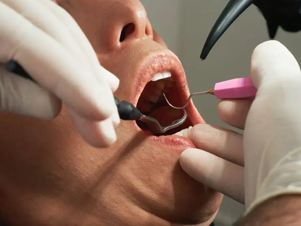 Zdjęcie Czy na pogotowiu dentystycznym wyrywają zęby w nagłych sytuacjach?