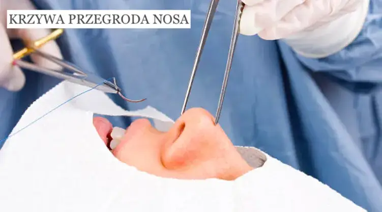 Zdjęcie Lekarz od nosa – jak się nazywa i kiedy warto go odwiedzić?