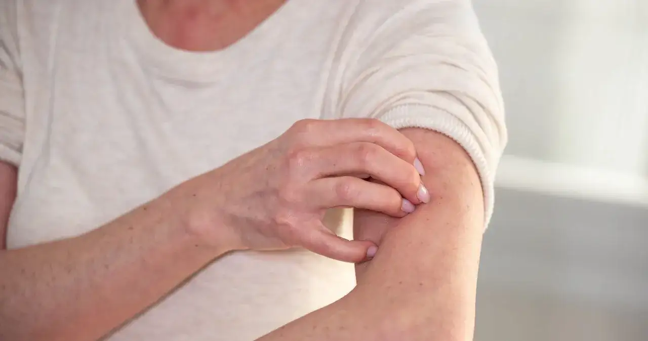 Zdjęcie Alergia na orzechy objawy – jak rozpoznać niebezpieczne reakcje