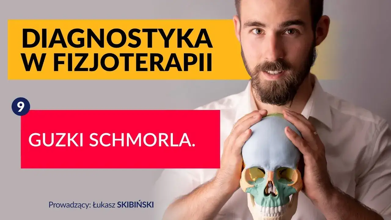 Zdjęcie Guzki Schmorla do jakiego lekarza? Dowiedz się, jak uniknąć bólu