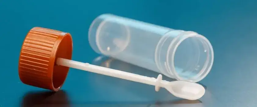 Zdjęcie Jakie badania na pasożyty pomogą uniknąć poważnych problemów zdrowotnych