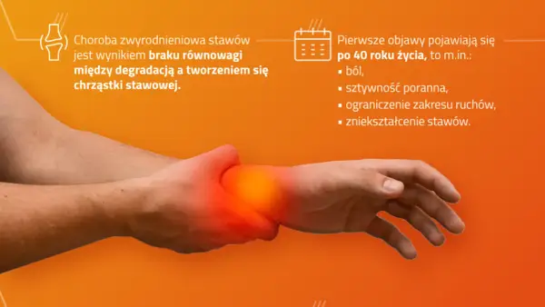 Zwyrodnienie stawów rąk do jakiego lekarza? Kluczowe informacje dla Ciebie